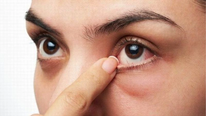 Giật mắt trái vào trưa